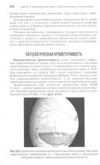 Неотложная педиатрия - Фото 13