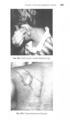 Неотложная педиатрия - Фото 14