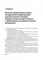Современные остеопластические материалы. Руководство для врачей - Фото 4