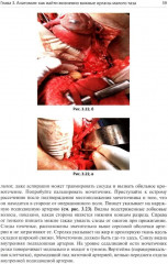 Атлас сложной гинекологической хирургии - Фото 13