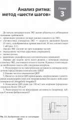 Карманный справочник по ЭКГ - Фото 4