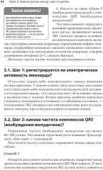 Карманный справочник по ЭКГ - Фото 5