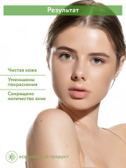 Крем-корректор против несовершенств «Anti-Acne Spot Cream» - Фото 7