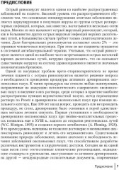 Активное дренирование околоносовых пазух при остром риносинусите - Фото 3