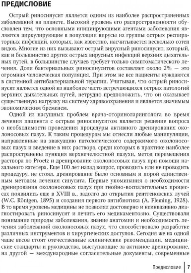 Активное дренирование околоносовых пазух при остром риносинусите