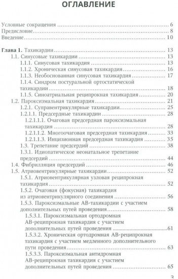 Аритмии сердца у детей и подростков