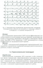 Аритмии сердца у детей и подростков - Фото 12
