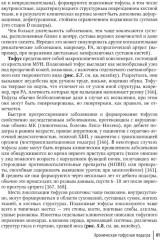 Подагра: руководство для врачей - Фото 9