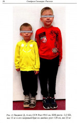 Синдром Сильвера-Рассела: клиника, диагностика, лечение - Фото 4