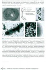 Эпидемиология туберкулеза - Фото 13