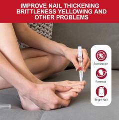 Капли от грибка ногтей - Фото 4