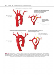 Атлас сосудистой анатомии Уфлакера. Ангиографический подход - Фото 10
