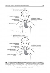 Неотложная помощь пациентам с техническими устройствами в критических состояниях и при обострении хронических заболеваний - Фото 5