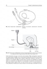 Неотложная помощь пациентам с техническими устройствами в критических состояниях и при обострении хронических заболеваний - Фото 6