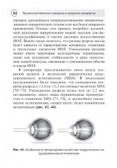 Техника роговичного разреза в хирургии катаракты - Фото 7