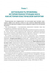 Атлас реконструкции носа - Фото 3