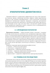 Атлас реконструкции носа - Фото 4