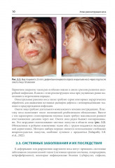 Атлас реконструкции носа - Фото 6