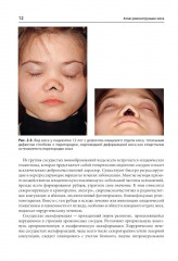 Атлас реконструкции носа - Фото 8