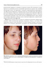 Атлас реконструкции носа - Фото 9