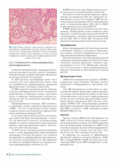 Краниофарингиомы - Фото 3