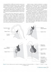 Краниофарингиомы - Фото 4