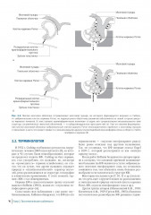Краниофарингиомы - Фото 5