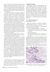 Краниофарингиомы - Фото 9