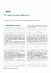 Краниофарингиомы - Фото 11