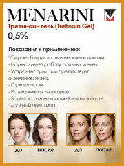 Гель для проблемной и возрастной кожи «Tretinoin Gel USP A-Ret Gel 0.05%» - Фото 4