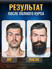 Набор сывороток-лосьонов для роста волос и бороды «Minoxidil 5%» - Фото 5