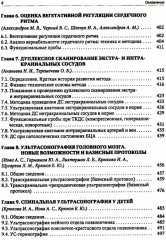 Функциональная и ультразвуковая диагностика в неврологии и нейрохирургии - Фото 9