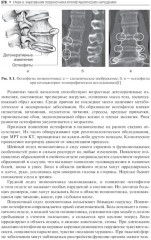 Повреждения и заболевания позвоночника - Фото 5