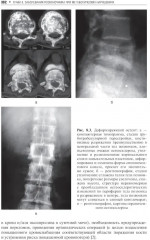 Повреждения и заболевания позвоночника - Фото 11