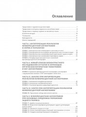 Флюоресцентная ангиография заднего полюса и периферии сетчатки - Фото 1