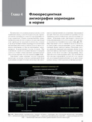 Флюоресцентная ангиография заднего полюса и периферии сетчатки - Фото 3
