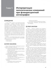 Флюоресцентная ангиография заднего полюса и периферии сетчатки - Фото 5