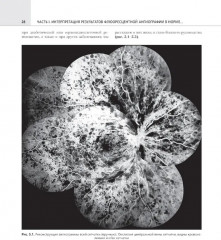 Флюоресцентная ангиография заднего полюса и периферии сетчатки - Фото 6