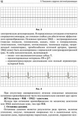 Скорая и неотложная помощь. Общие вопросы реаниматологии - Фото 9