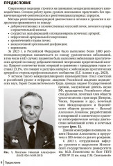 Эмболизация простатических артерий в лечении доброкачественной гиперплазии предстательной железы - Фото 3