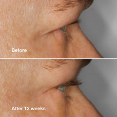 Сыворотка для ресниц «Lash Amplifying Serum» - Фото 3