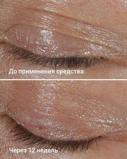 Крем для кожи вокруг глаз «Wrinkle Correcting Eye Cream»