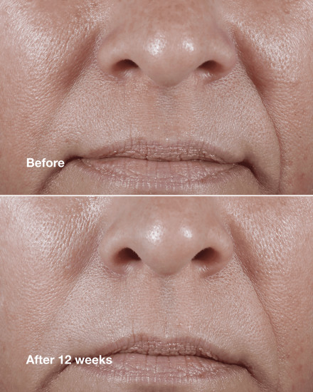 Крем для лица антивозрастной «Wrinkle Correcting Rich Cream»