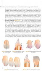 Ортопедическая стоматология. Технология зубных и челюстных протезов - Фото 8