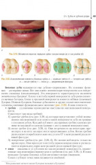 Ортопедическая стоматология. Технология зубных и челюстных протезов - Фото 11