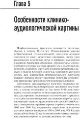 Профессиональная тугоухость - Фото 8