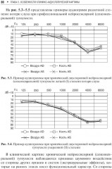 Профессиональная тугоухость - Фото 10