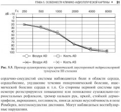 Профессиональная тугоухость - Фото 11
