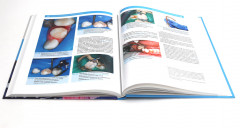 Детская стоматология. Лечение кариеса у детей раннего возраста. Комплект из 2 книг - Фото 5