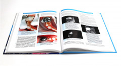 Детская стоматология. Лечение кариеса у детей раннего возраста. Комплект из 2 книг - Фото 7